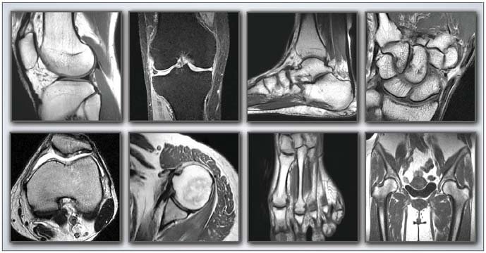 MSK MRI Radiology Cases
