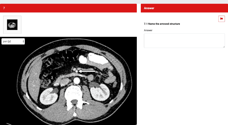 CT scan showing superior mesenteric artery FRCR anatomy