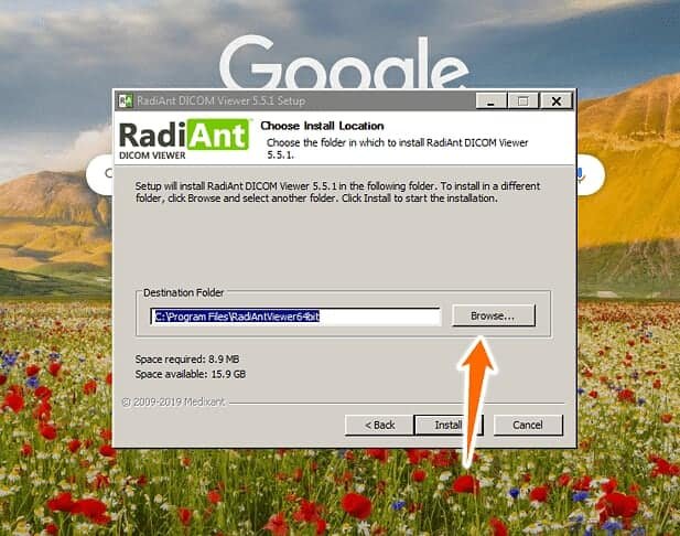 Radiant DICOM viewer install location