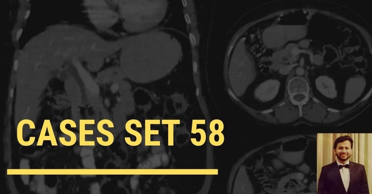 Spotters set 58 - Interesting Radiology cases