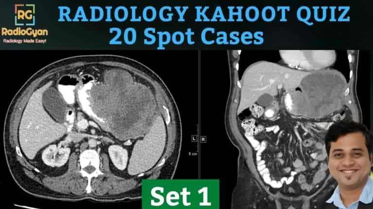 Radiology Kahoot Quiz