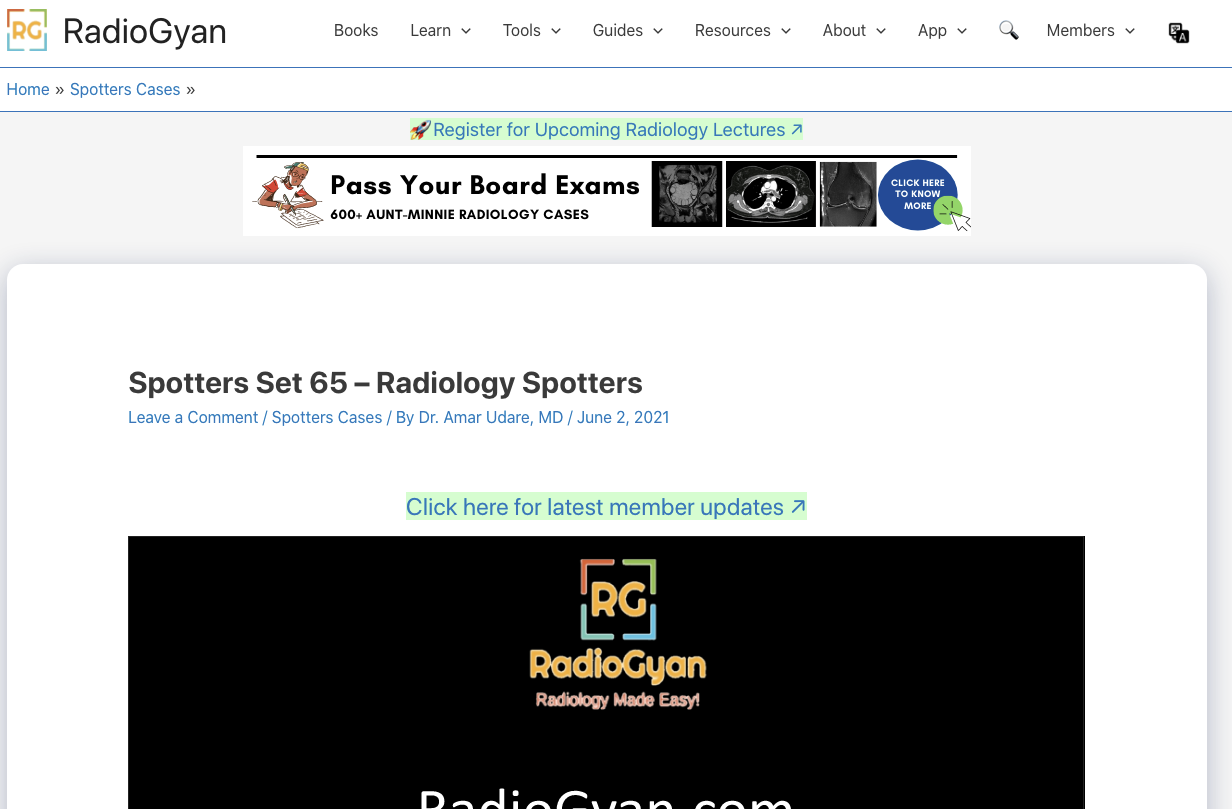 Radiogyan Radiology Spotters Interface