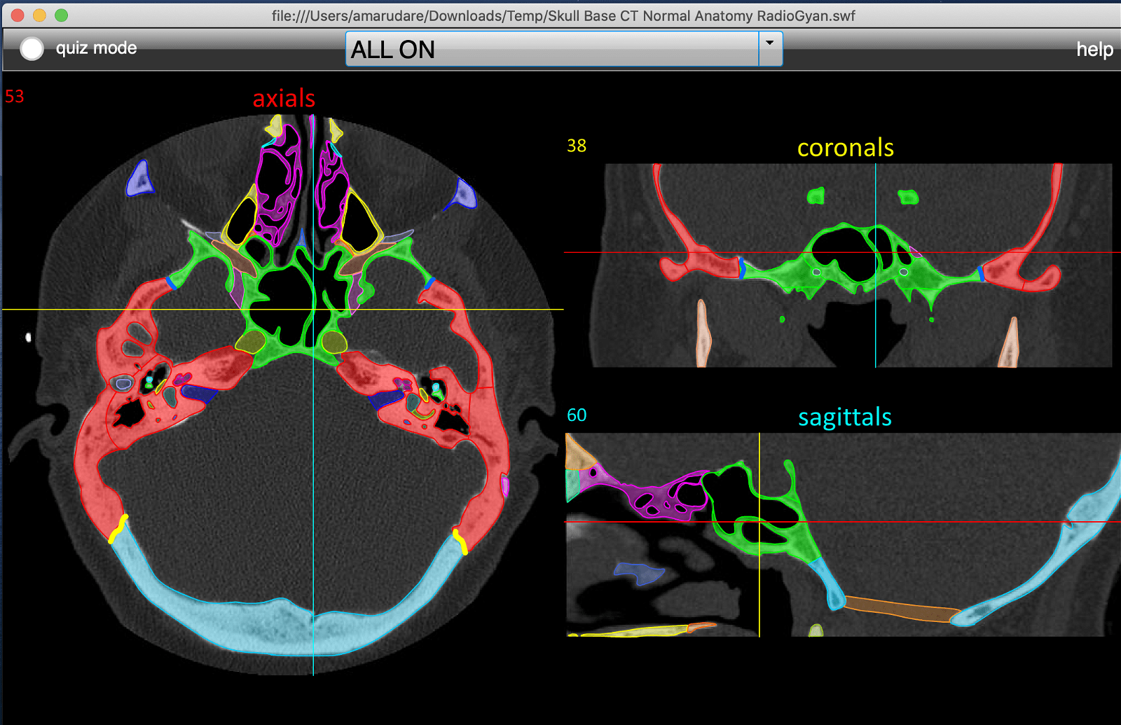 HeadNeckBrainSpine Anatomy Modules using Adobe Debugger