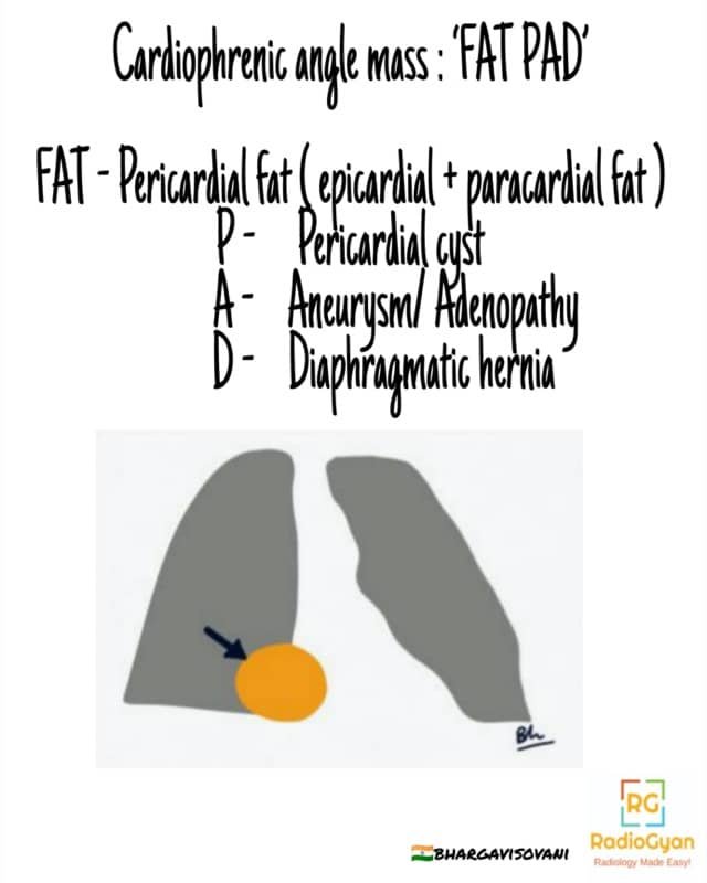 Pleuropericardial Fat Pad Differentials