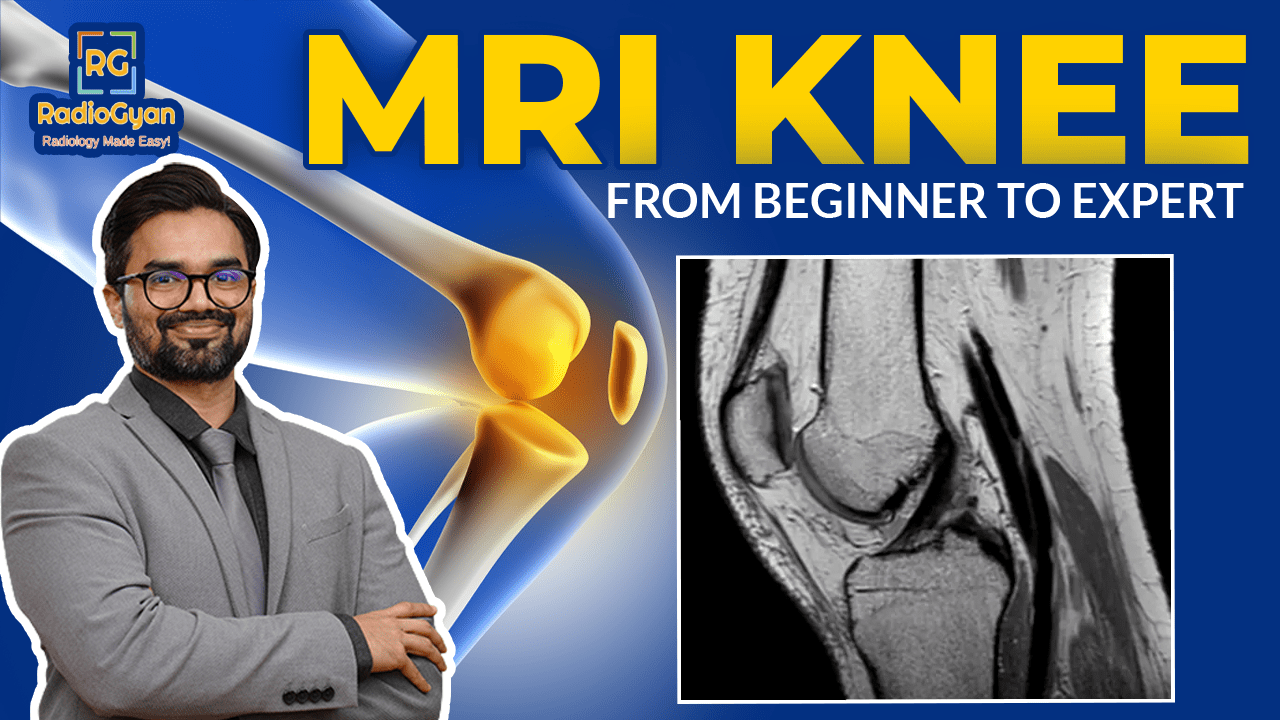 MRI Knee Tutorial