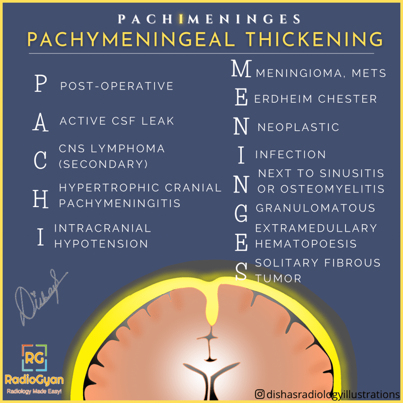 Differential Diagnosis for Pachymeningeal Thickening