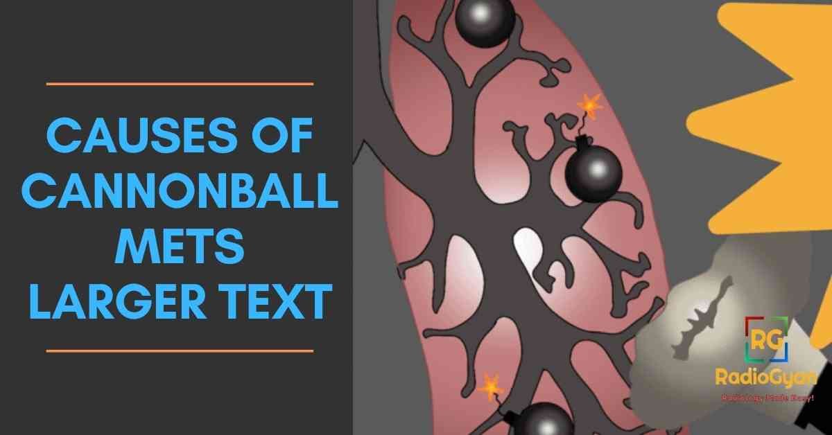 causes of Cannonball Mets Larger Text