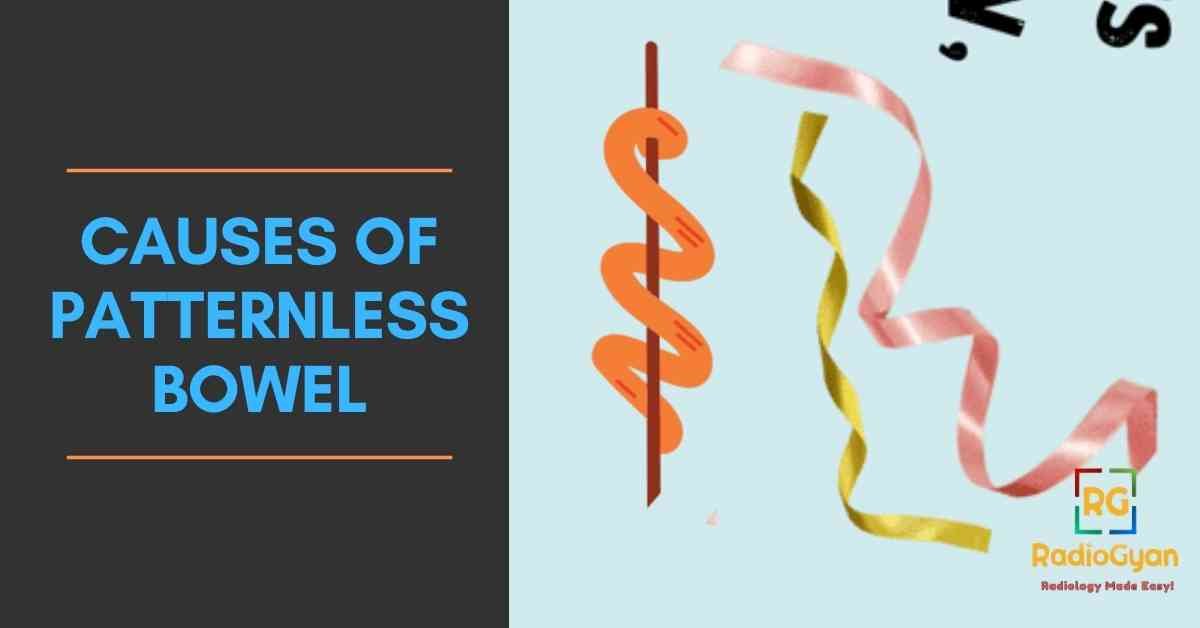 causes of Patternless Bowel
