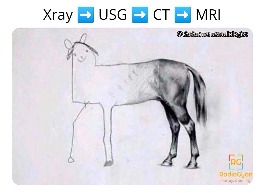 A meme showing how the image quality of a horse sketch improves with different radiological modalities. The first panel is labeled â€œx-rayâ€� and shows a crude outline of a horse. The second panel is labeled â€œultrasoundâ€� and shows a fuzzy sketch of a horse with some shading. The third panel is labeled â€œCTâ€� and shows a detailed drawing of a horse with bones and organs visible. The fourth panel is labeled â€œMRIâ€� and shows a realistic image of a horse with colors and textures.