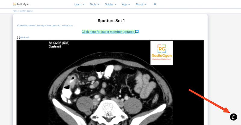 How to Access GyaniBot Radiology ChatGPT 1