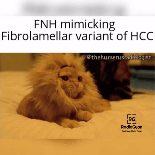  A humorous meme showing the difference between FNH and fibrolamellar HCC on imaging using a cat and a lion analogy.