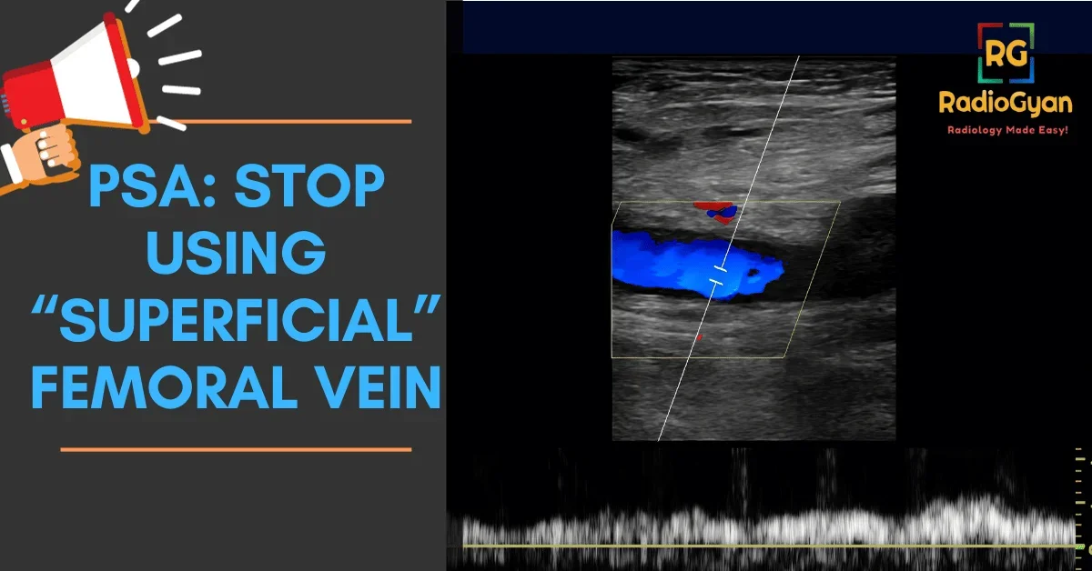 Ultrasound image of the femoral vein