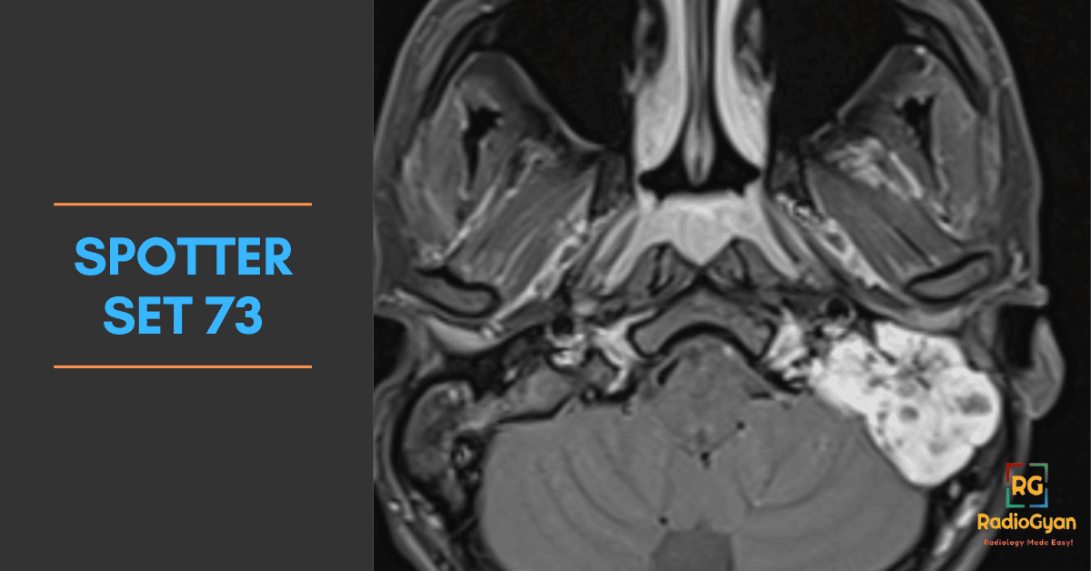 Spotters Set 73 – Neuroradiology Cases